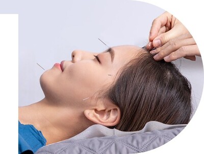 Link to: /pages/acupuncture-2